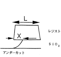 アンダーカット量